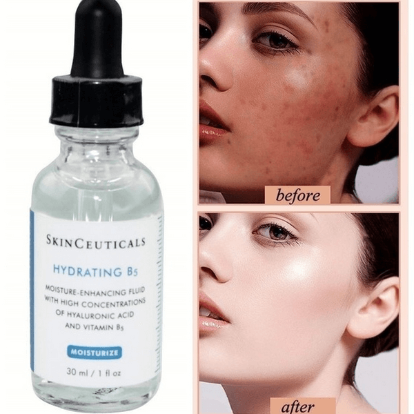 Làn da trước và sau khi dùng Serum Skinceuticals Hydrating B5