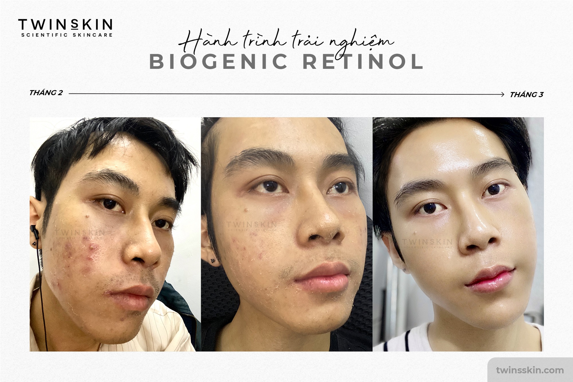 Công dụng dưỡng da của Biogenic Retinol Twins Skin 1% For Advance Full Size 30ml 
