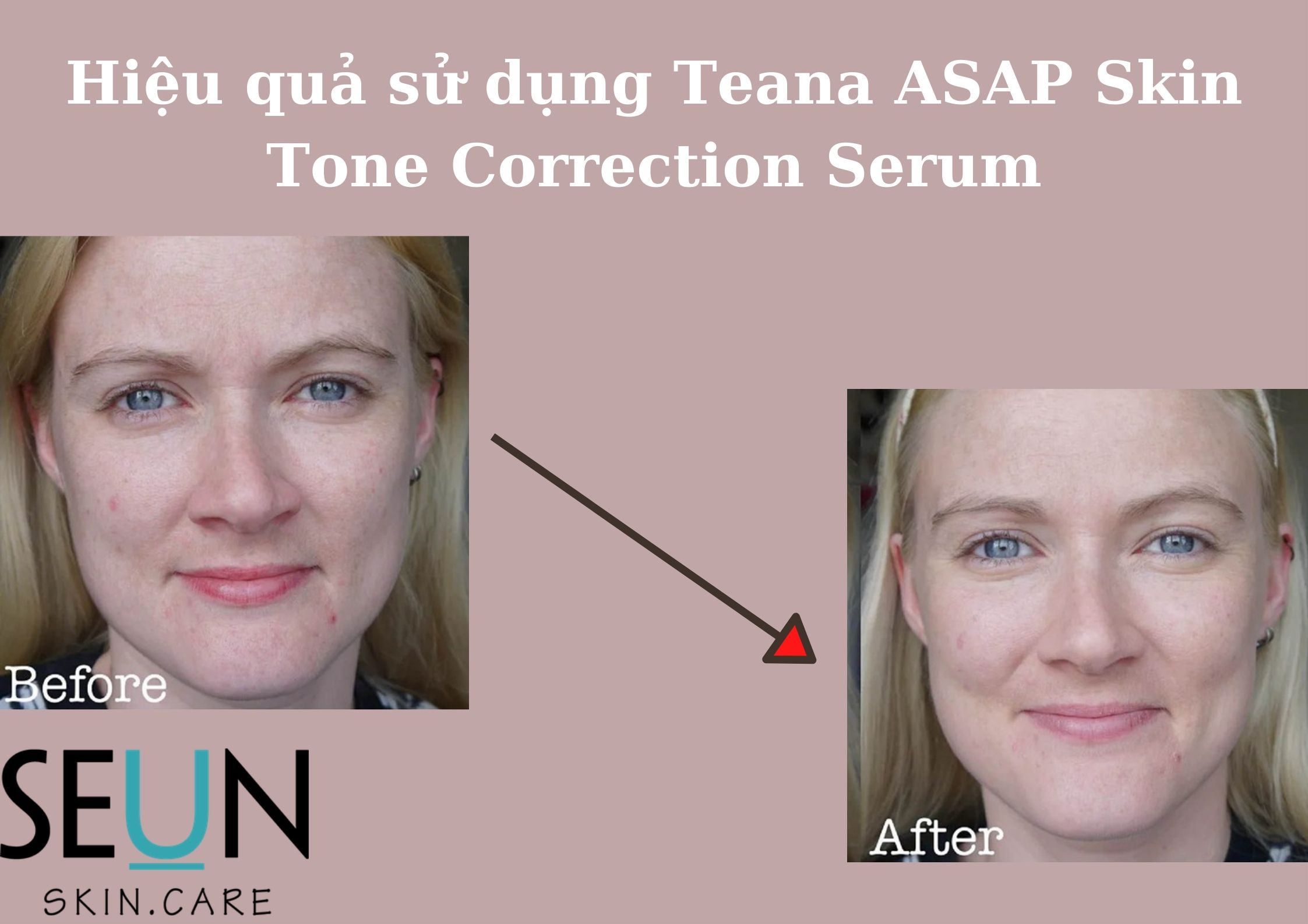 Hiệu quả sử dụng Teana ASAP Skintone Correction Serum